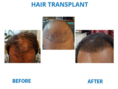 hair transplant clinic
